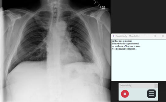 Micro Editor Sample Report